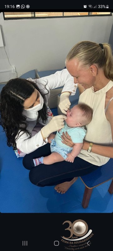 CERNIC realiza instalação de placas palatinas de memória em bebês com síndrome de Down.